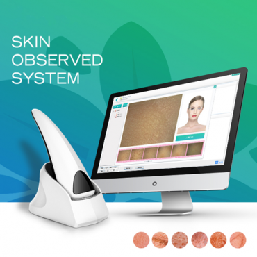 New Portable Skin Analyzer For Diagnosis Epidermis and Dermis and UV Layer
